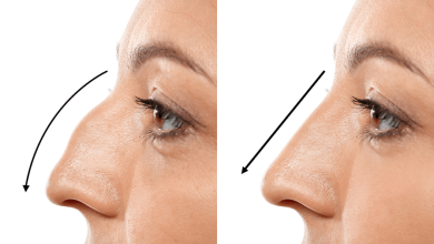 12 Tips for a Speedy Recovery After Rhinoplasty